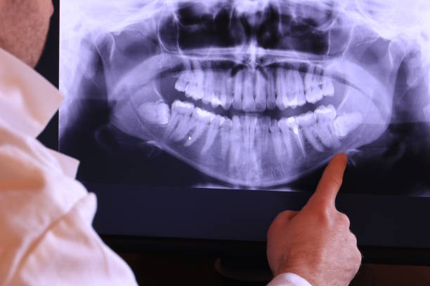 Best Broken or Cracked Tooth Emergency Dentist in Funny River, AK